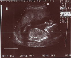 baby at 20 weeks