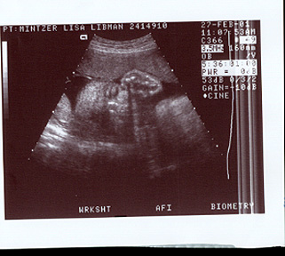 baby's face at 30 weeks